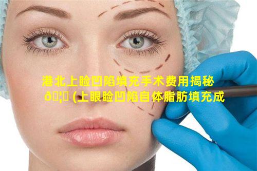 港北上睑凹陷填充手术费用揭秘 🦉 (上眼睑凹陷自体脂肪填充成活率高吗)